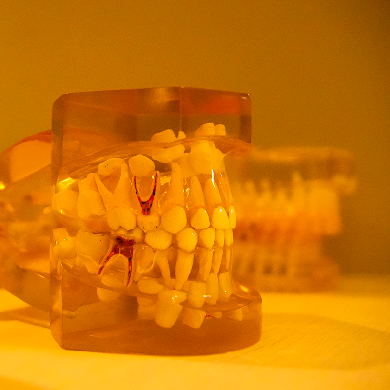 site-rotta-ago-extra-03